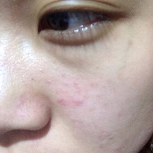 皮膚發(fā)出求救信號(hào)別忽視！